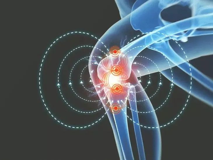 黑科技石墨烯发热磁护膝，1分钟暖到骨头里(图6)